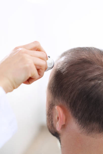 istock Hair analysis. Trichological examination. 964172502