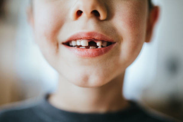 boy shows off missing tooth - toothless grin imagens e fotografias de stock