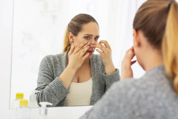 istock Attractive earnest woman squeezing out pimple 964746556