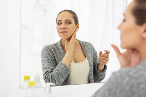 istock Dissatisfied discontented woman examining her face 964746618