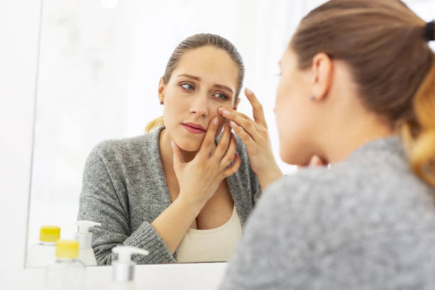 istock Focused beautiful woman getting rid from pimple 964746660