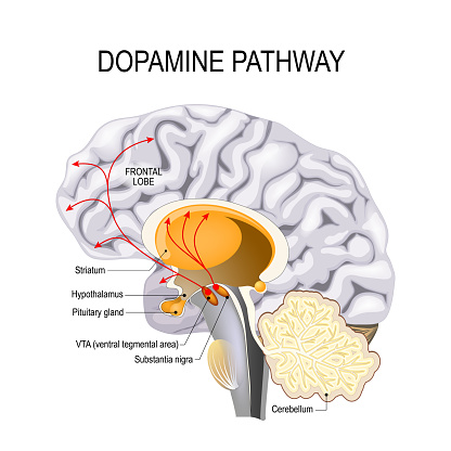 Dopamine hypothesis of schizophrenia. dopamine pathway dysfunction. Humans brain with dopamine pathways.