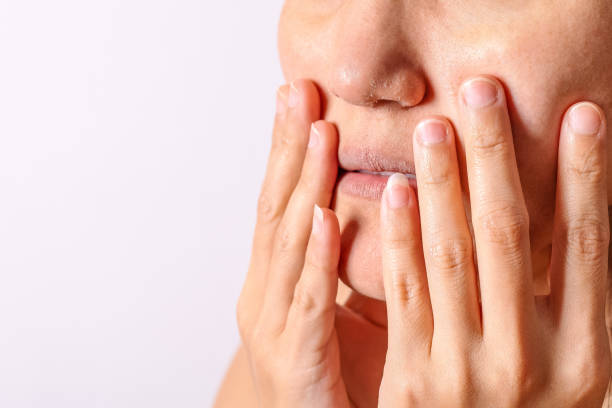 allergische frauen haben neurodermitis trockene nase und lippen auf winter saison closeup. - trockenlandschaft stock-fotos und bilder