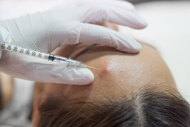 istock Cosmetologist in spa beauty salon doing acne treatment using mechanical instrument. 965325472