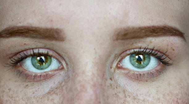 istock Woman with freckles 965360908