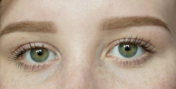 istock Woman with freckles 965360976