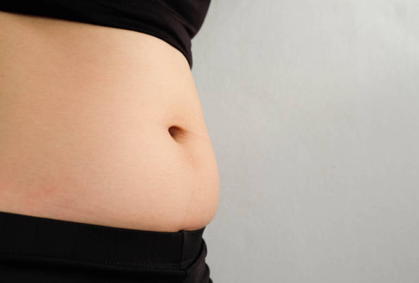 istock Side of Fat body belly paunch , diabetic risk factor 965444448