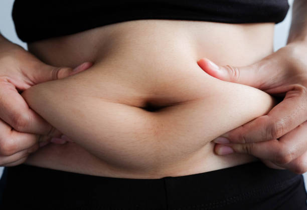istock woman hand catching fat body belly paunch , diabetic risk factor 965444494
