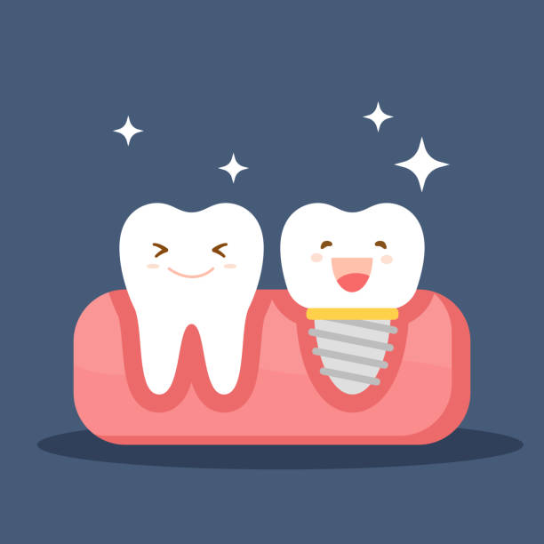 歯科インプラントと通常の歯。口腔内に復元します。歯学部をテーマにフラットの図。ベクター グラフィックは、青い背景に分離されました。 - dentist pain human teeth toothache点のイラスト素材／クリップアート素材／マンガ素材／アイコン素材