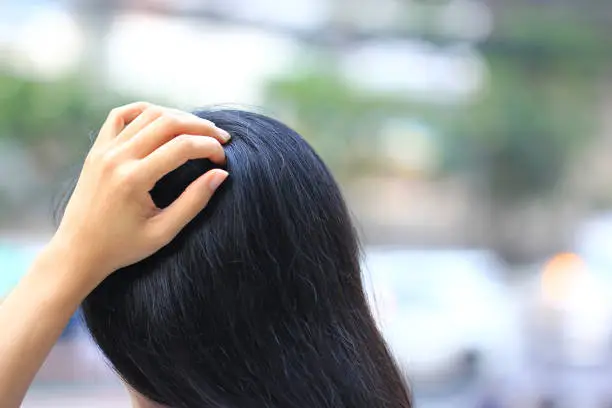 Close-up of woman hand itchy scalp fungus, Haircare concept