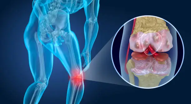 Knee pain Attack, man suffering from knee. 3D illustration