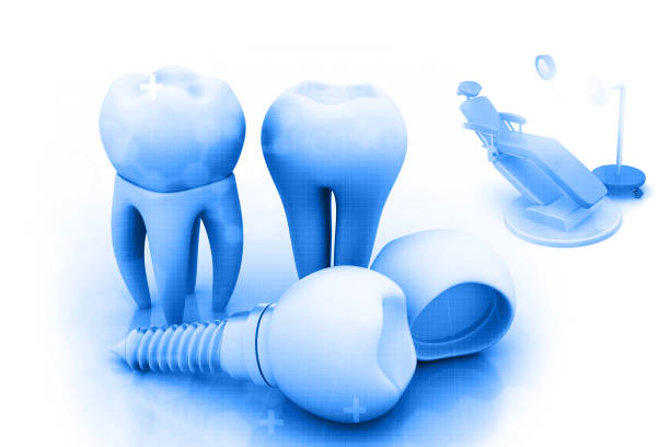 istock Dental implant , human Tooth 966267818