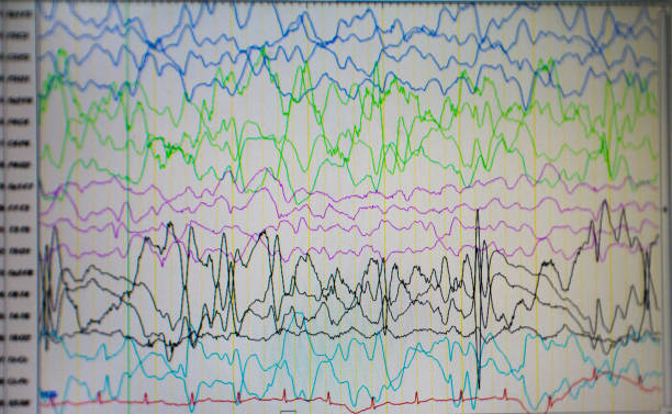 computer-monitor zeigt die elektrische aktivität des anormalen gehirns, eeg der pädiatrischen patienten mit problemen im gehirn. - eeg epilepsy science electrode stock-fotos und bilder