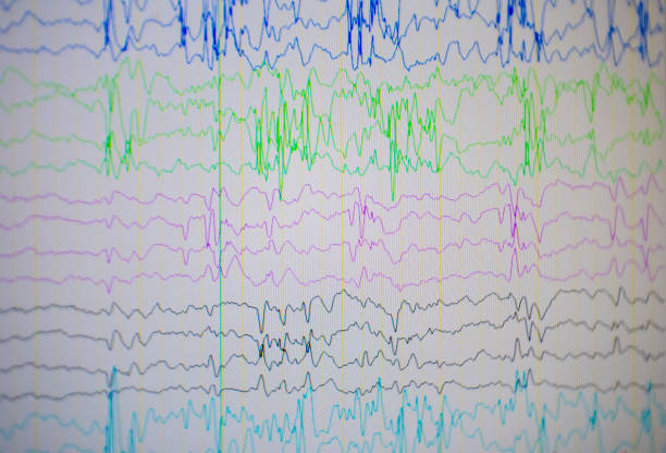 einem computer-monitor zeigt die elektrische aktivität der anormale gehirn, elektroenzephalogramm, eeg - eeg epilepsy science electrode stock-fotos und bilder