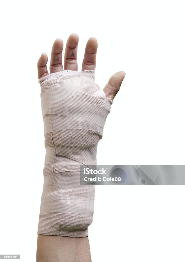 Рука хирургического вмешательства - Стоковые фото Кистевой туннельный синдром роялти-фри