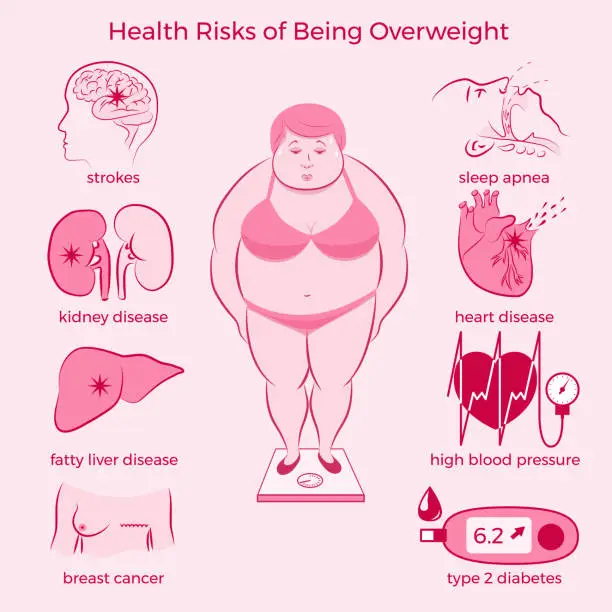 Vector illustration of Health Risks of Being Overweight Set.