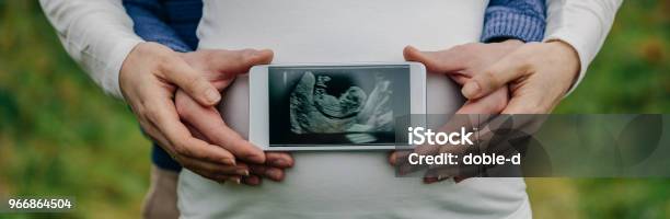 Man Showing Ultrasound Over His Wifes Belly Stock Photo - Download Image Now - Pregnant, Ultrasound, Announcement Message