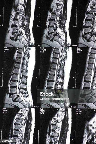 Rmi Lombosacrale - Fotografie stock e altre immagini di Magnete - Magnete, Anatomia umana, Apparecchiatura per la RMN