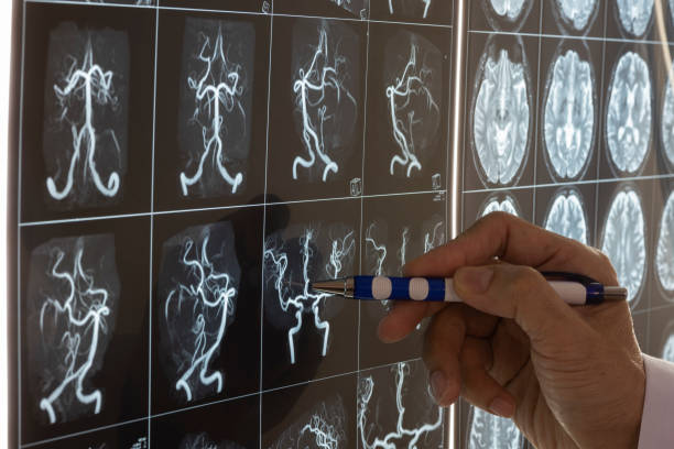 istock Doctor demonstarting brain MRI anatomy 966973670