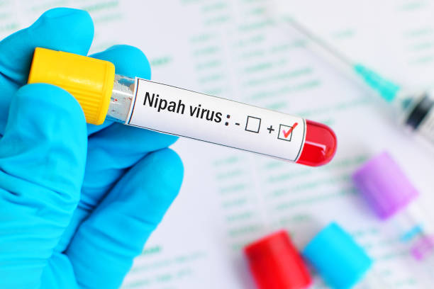 virus nipah positivo - swine flu immagine foto e immagini stock