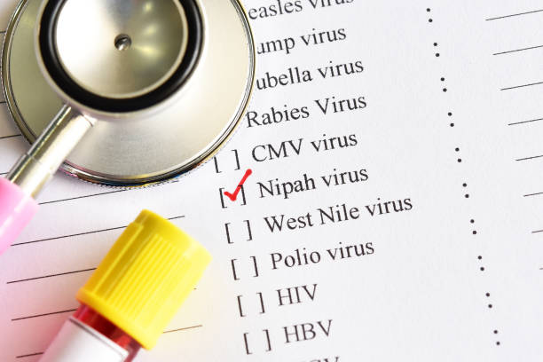 test del virus nipah - swine flu immagine foto e immagini stock