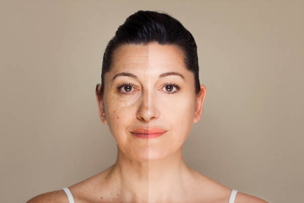 potret wanita sebelum dan sesudah program anti-penuaan - sebelum-dan-sesudah-foto potret stok, foto, & gambar bebas royalti