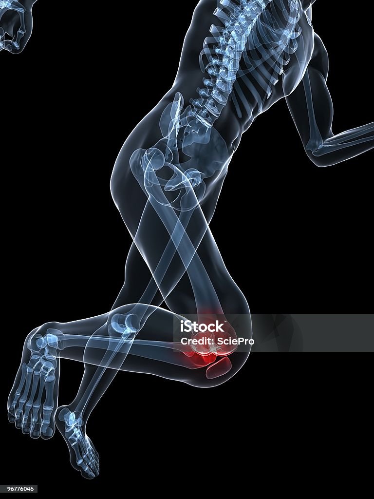 Schmerzhafte Knie - Lizenzfrei Anatomie Stock-Foto