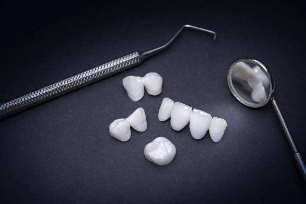 istock Dental tools and zircon dentures on a dark background - Ceramic veneers - lumineers 967792878