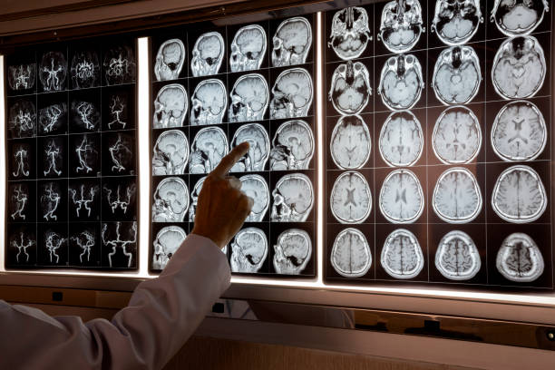 Doctor pointing at MRI of human brain Doctor pointing at MRI of human brain on the light box to demonstrate anatomy examining x ray stock pictures, royalty-free photos & images