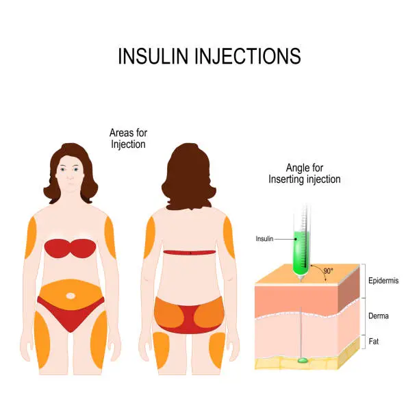 Vector illustration of insulin injections