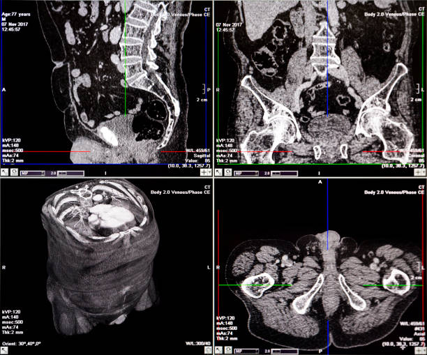 tomografia komputerowa ludzkiego kręgosłupa - mri scan cat scan machine x ray brain zdjęcia i obrazy z banku zdjęć