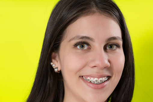 Beautiful seventeen years old latin lady in a studio portrait, She is looking at the camera, She is smiling, She has long smooth hair and green eyes. The background is bright yellow. This is an extreme close-up headshot. She is wearing braces.