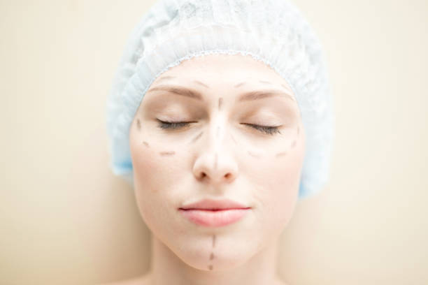 얼굴의 성형 수술 - plastic surgery botox injection face lift nose job 뉴스 사진 이미지