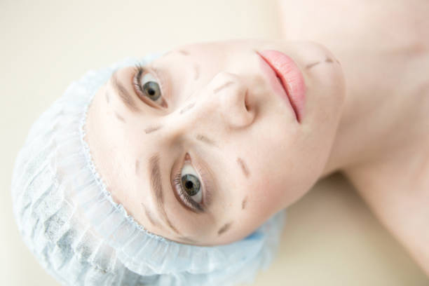 해제 절차 - plastic surgery botox injection face lift nose job 뉴스 사진 이미지