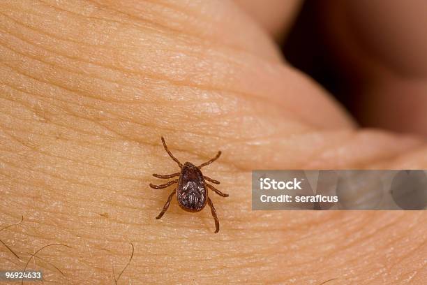 Tick On My Hand Stock Photo - Download Image Now - Tick - Animal, Bedbug, Human Flea