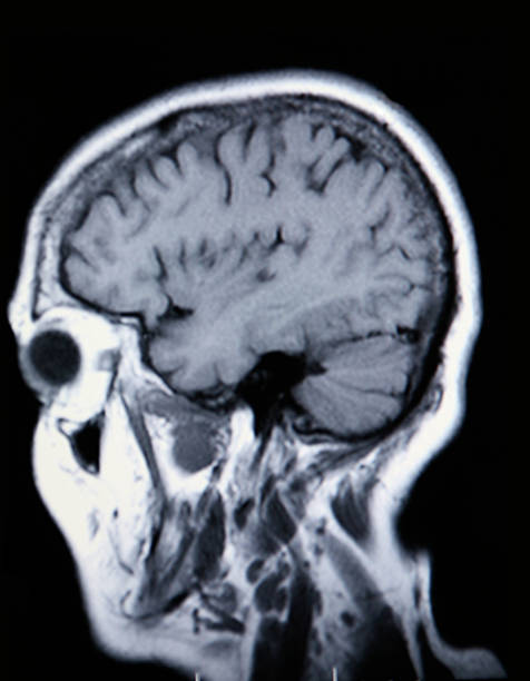 istock Medical MRI Image Showing Brain and Skull 96928563