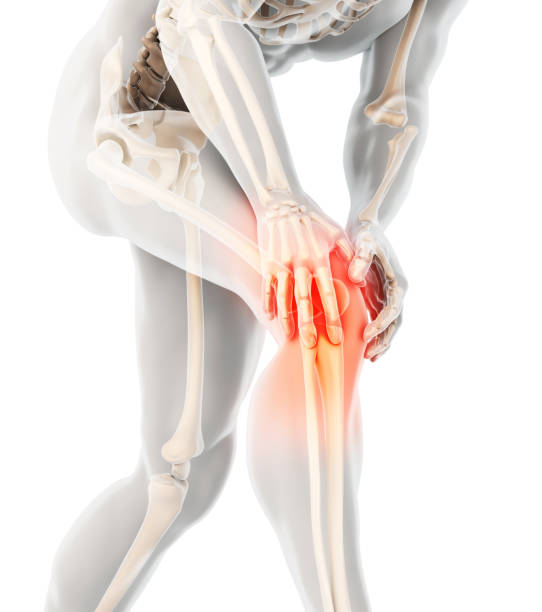колено болезненное - скелетный рентген. - massaging sport men professional sport стоковые фото и изображения