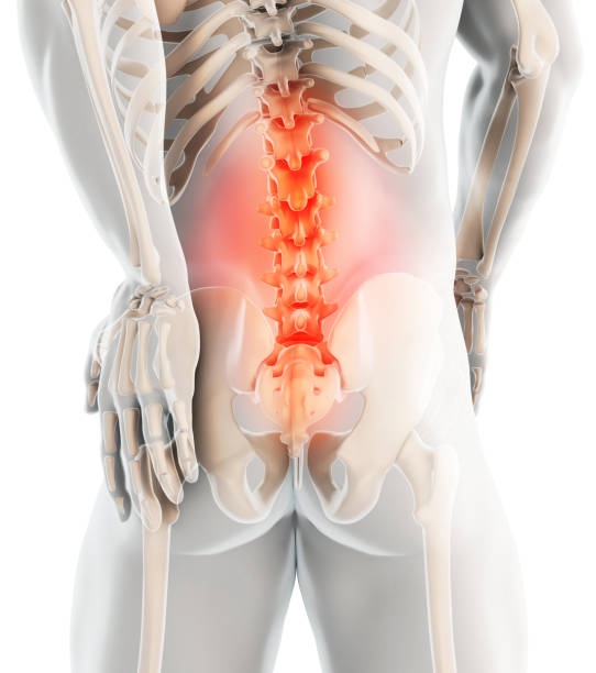 istock 3D Illustration of sacral spine painful. 969667574