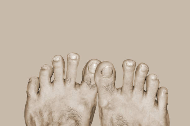 istock Bad healthy care feet 970060662