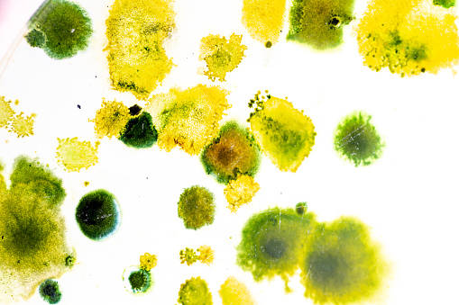 Colony Characteristics of Fungus and algae in petri dish for education.