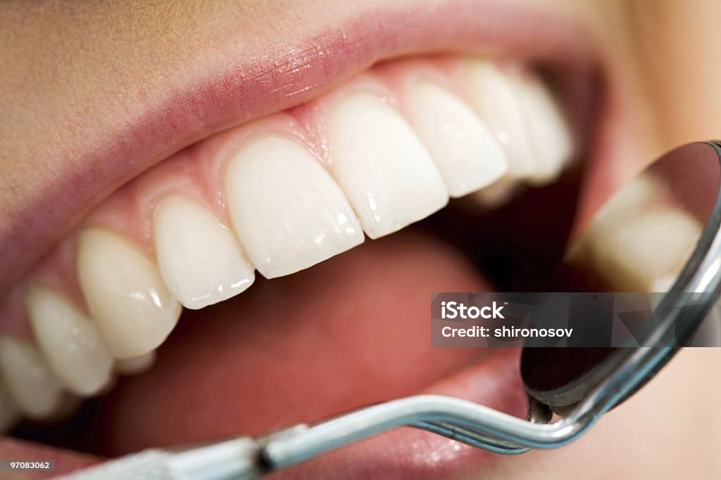 Mouth checkup  Close-up Stock Photo