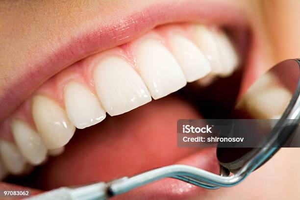 Mouth Checkup Stock Photo - Download Image Now - Close-up, Color Image, Dental Equipment