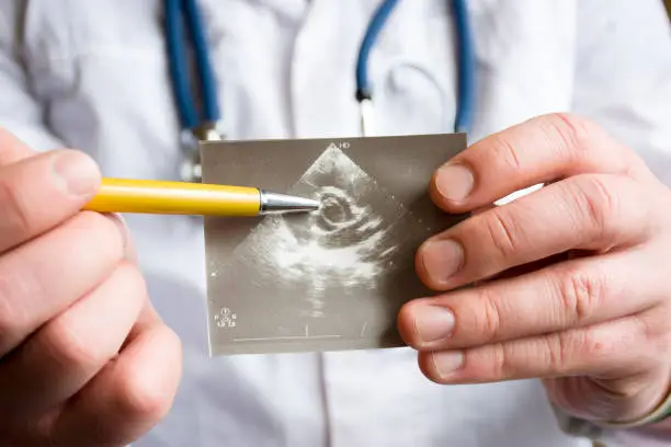 Photo of Doctor holds snapshot of ultrasound of heart and indicates with ballpoint pen on possible pathology of heart aortic valve. Concept photo of cardiac ultrasonic diagnostics of valve apparatus in adults