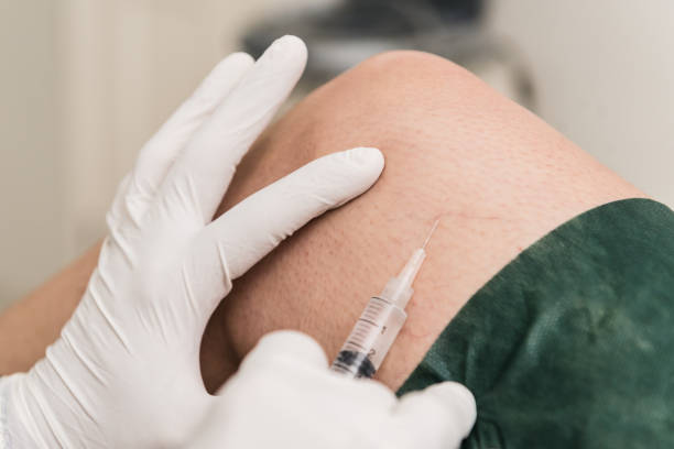istock Sclerotherapy, treatment to remove microvarices 970942056