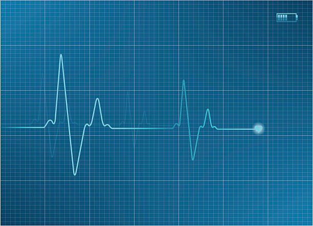 Electrocardiogram Detailed vector EKG. Easy editable because all objects are separated from each other and at desire can move and brush. caduceus medical symbol backgrounds stock illustrations
