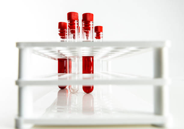 tubos para toma de muestras de sangre - test tube isolated nobody empty fotografías e imágenes de stock