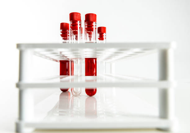 трубы для отбора проб крови - blood blood sample blood donation tube стоковые фото и изображения