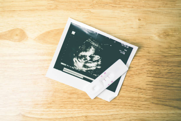 istock ultrasound with pregnancy test 972003756