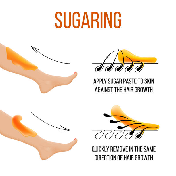 탈모 및 sugaring입니다. 머리 제거입니다. 여 포입니다. 설탕 또는 왁 스의 여자 다리 전후. 프로세스와 탈모의 단계입니다. 벡터 일러스트 레이 션 - waxing stock illustrations