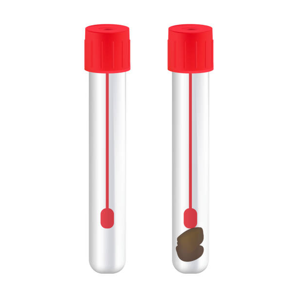 Glass vial with red cap empty and with stool sample. Medical laboratory tests vector art illustration